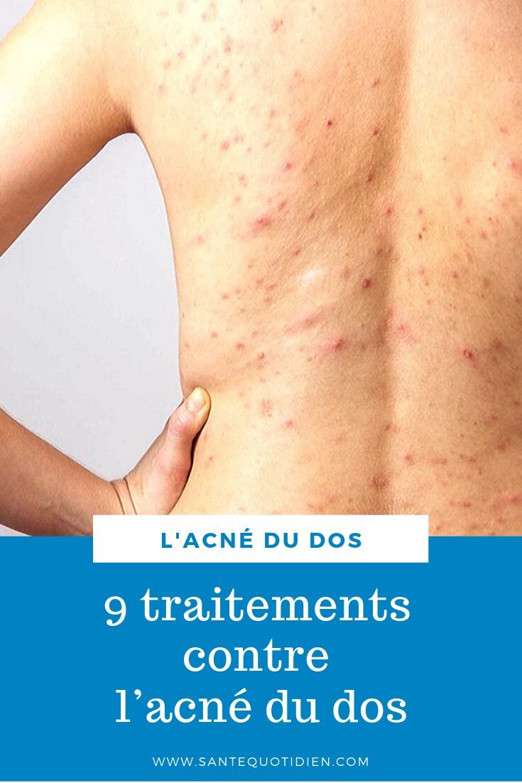 découvrez des remèdes efficaces et naturels pour éliminer les boutons sur le dos, prévenir leur apparition et retrouver une peau saine. conseils, astuces et solutions adaptées à tous types de peaux.