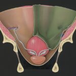 découvrez des remèdes efficaces pour soulager les brûlures vulvaires rapidement et en toute sécurité.