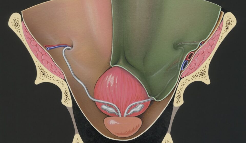 découvrez des remèdes efficaces pour soulager les brûlures vulvaires rapidement et en toute sécurité.